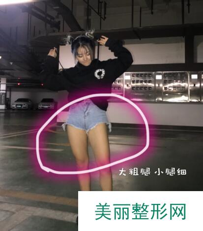 吸脂瘦全身日记来袭，小姐姐还是应该苗条一点