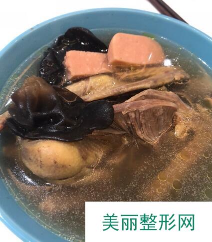 海峡医院自体肋软骨隆鼻日记