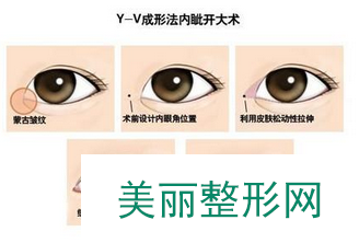南京施尔美整形医院院双眼皮价格表曝光一览