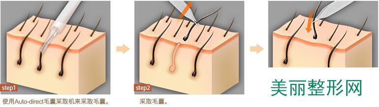 北京美联臣整形医院价目表全新曝光一览