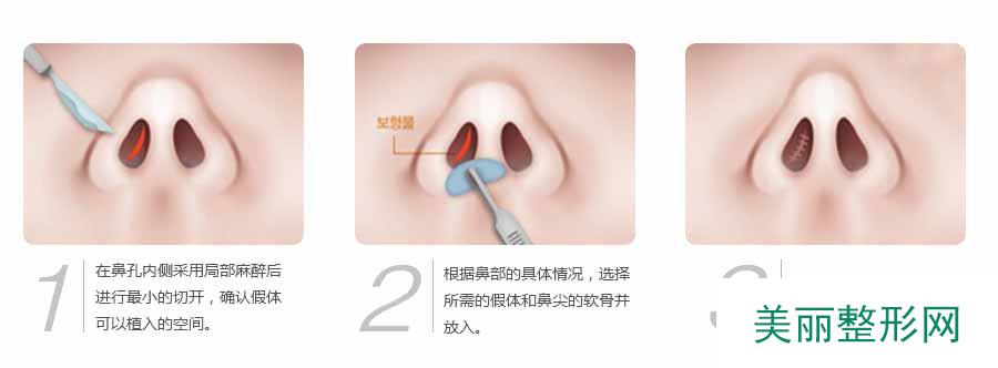 宿州汉密尔顿美容医院价格表惊艳预览
