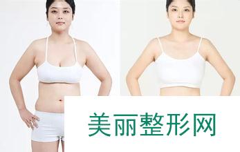 沈阳蓝天整容医院新版价格表抢鲜价