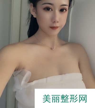 成都美莱医院吴江山为我做的假体隆胸手术后5天