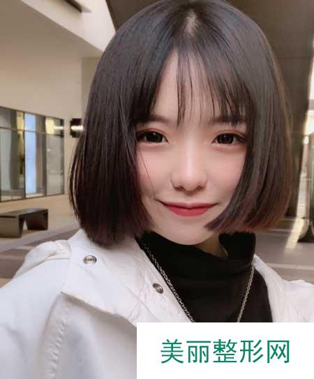 青岛市中心医院整形美容科做双眼皮案例分享