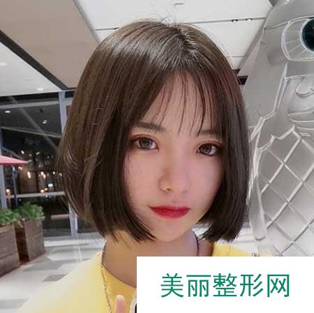 青岛市中心医院整形美容科做双眼皮案例分享