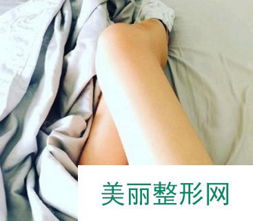 杭州格莱美李树平医师真人大腿吸脂案例 以及分享吸脂价格