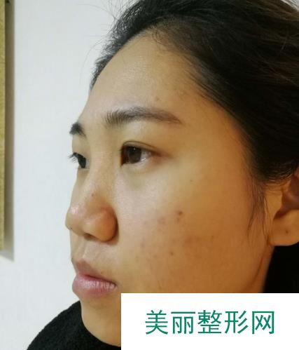 #掌握#厦门第一医院美容科有哪些项目？收费情况+整形案例~