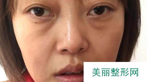 [实力]蚌埠第一人民医院整形科医生名单全，附四月价格表~