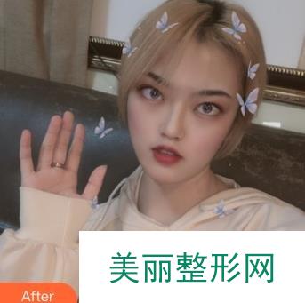[术前功课]怀化第一人民医院有整形科吗？医生实力&成功案例~