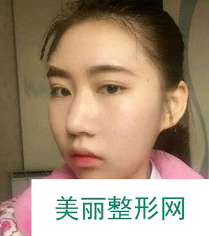 更新！南昌大学第一附属医院美容整形价格表及医生名单在线获取~