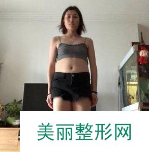 厦门大学附属第一医院整形美容科简介丨医生名单丨案例大合集~