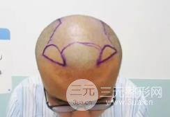 武汉碧莲盛案例