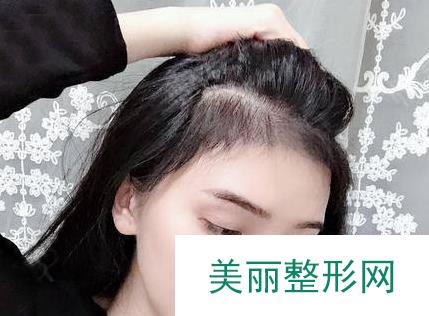 成都恒博植发医院