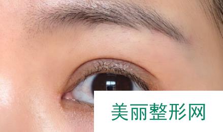 上海九院张余光案例