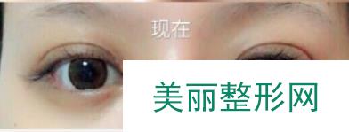长海医院宋建星
