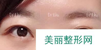 华东医院刘天一