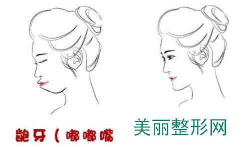 江苏省口腔南京市口腔医院哪个好
