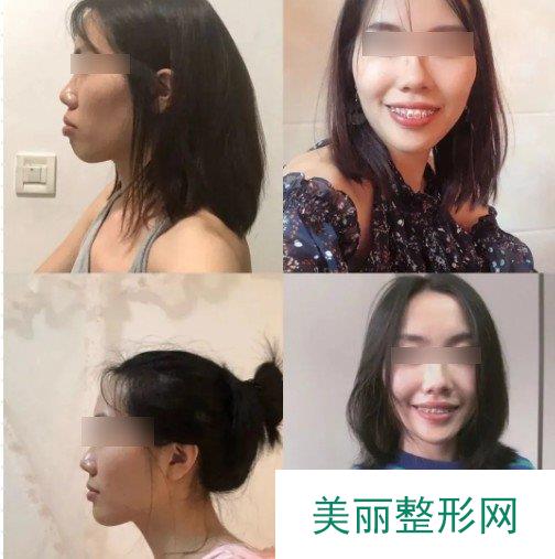 沈阳医大一院正畸一科和二科