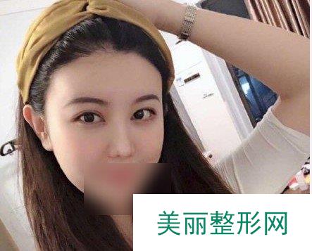 304医院植发是个人承包的吗
