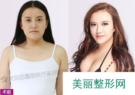 沈阳百嘉丽医院靠谱吗？新版简介-价格表-案例图发布