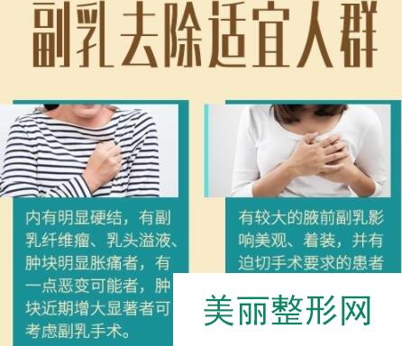 中国医学科学院美容整形去副乳手术适合人群