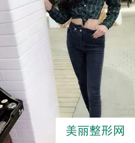 大腿吸脂