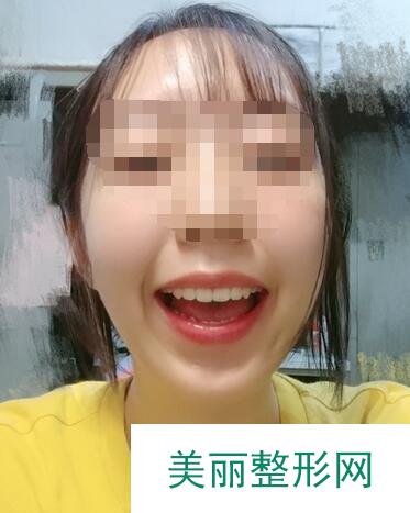 牙齿正畸