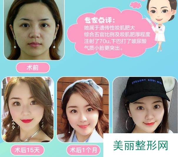 医院点评