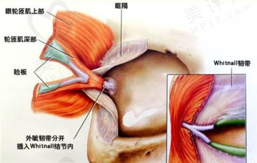 西安艺星整形医院做双眼皮好不好 西安艺星整形医院做双眼皮好不好
