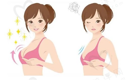 南京艺星整形隆胸优势 南京艺星整形隆胸优势