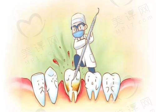 牙齿缝隙修复方法