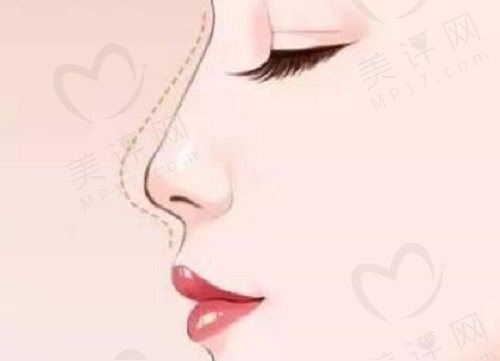 佛山曙光金子整形医院口碑如何 佛山曙光金子整形医院口碑如何
