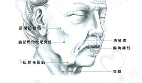 冯中和医生拉皮技术好 冯中和医生拉皮技术好