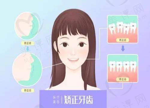 做了牙齿矫正要带一辈子保持器吗 做了牙齿矫正要带一辈子保持器吗