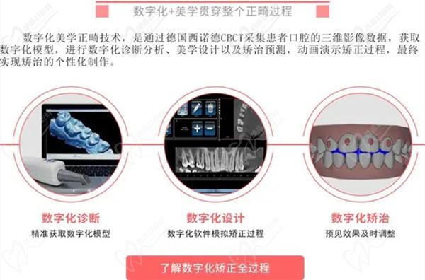 数字化矫正