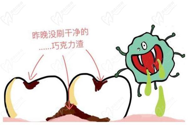小孩更容易受到龋齿侵蚀 小孩更容易受到龋齿侵蚀