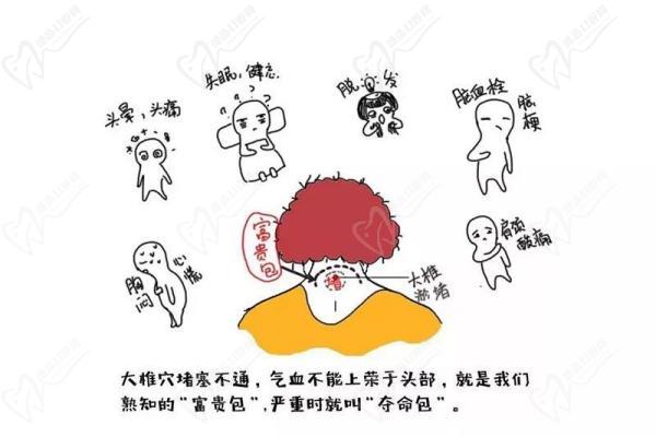 北京富贵包手术价格表 北京富贵包手术价格表