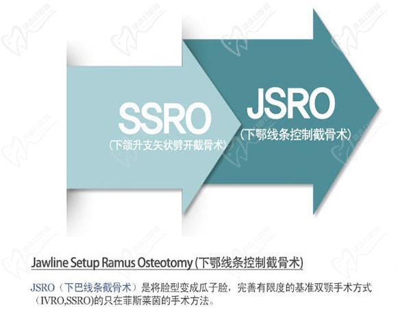 韩国菲斯莱茵整形医院怎么样？双鄂手术在韩国医院排名靠前