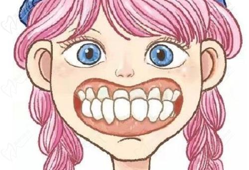 兰州皓亚口腔医院矫正牙齿怎么样 兰州皓亚口腔医院矫正牙齿怎么样