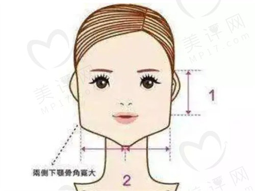 上海华美李志海磨骨手术价格是多少? 上海华美李志海磨骨手术价格是多少?