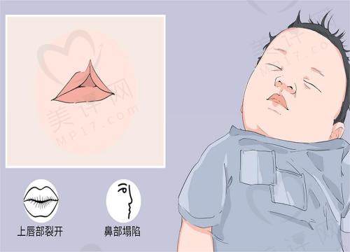 重庆美仑美奂整形医院做唇腭裂好吗 重庆美仑美奂整形医院做唇腭裂好吗