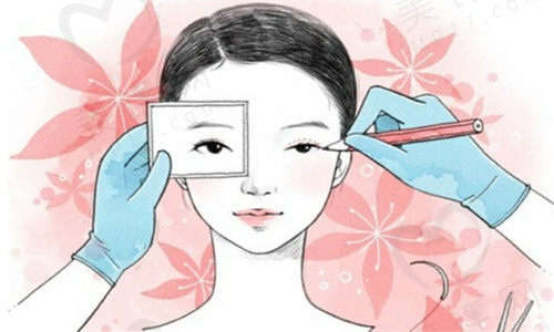北京丽星翼美眼修复中心怎么样 北京丽星翼美眼修复中心怎么样