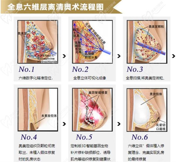 全息六维层离清奥术 全息六维层离清奥术