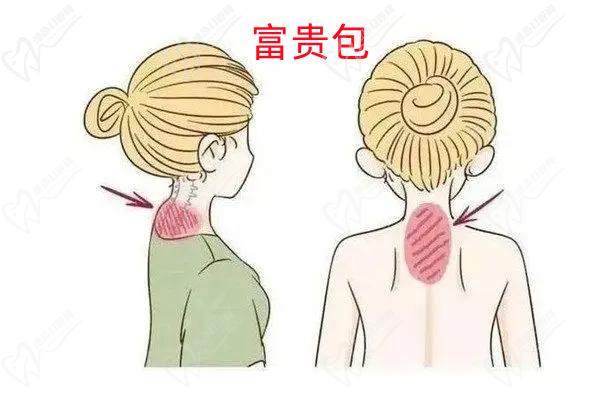 富贵包 富贵包