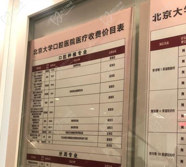 北京大学口腔医院种植牙收费标准更新,瑞士ITI种植牙9000元起 北京大学口腔医院种植牙收费标准更新,瑞士ITI种植牙9000元起
