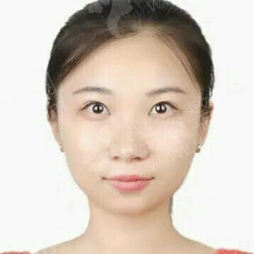 1626940639805986.jpg 术前.jpg