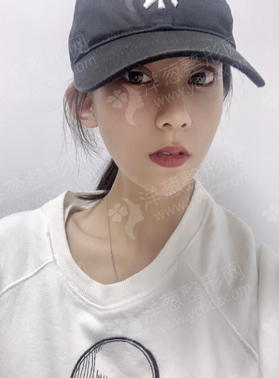 术中.jpg