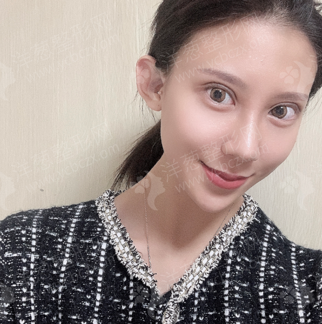 术后.jpg