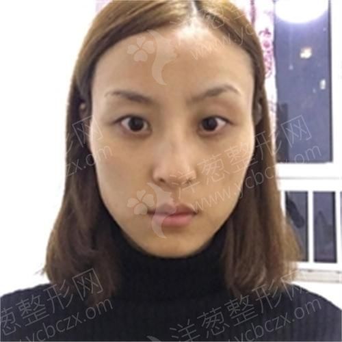 图11.jpg