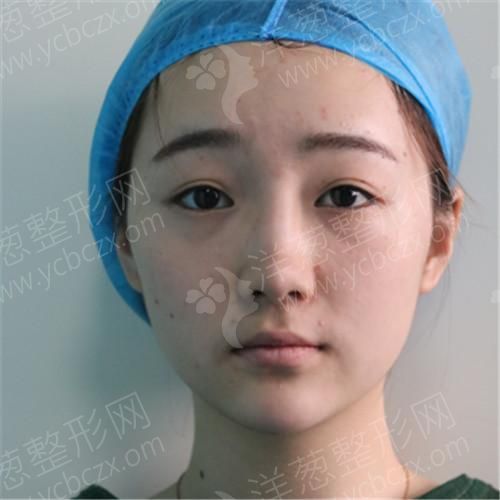 1627292251161029.jpg 术前(38).jpg